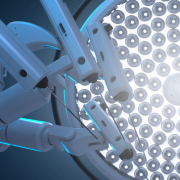 Computer-Assisted Joint Surgery