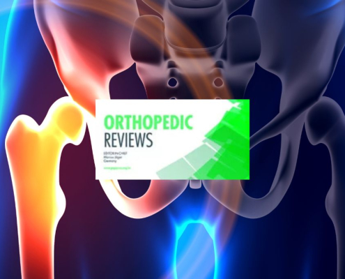 infected joint replacements